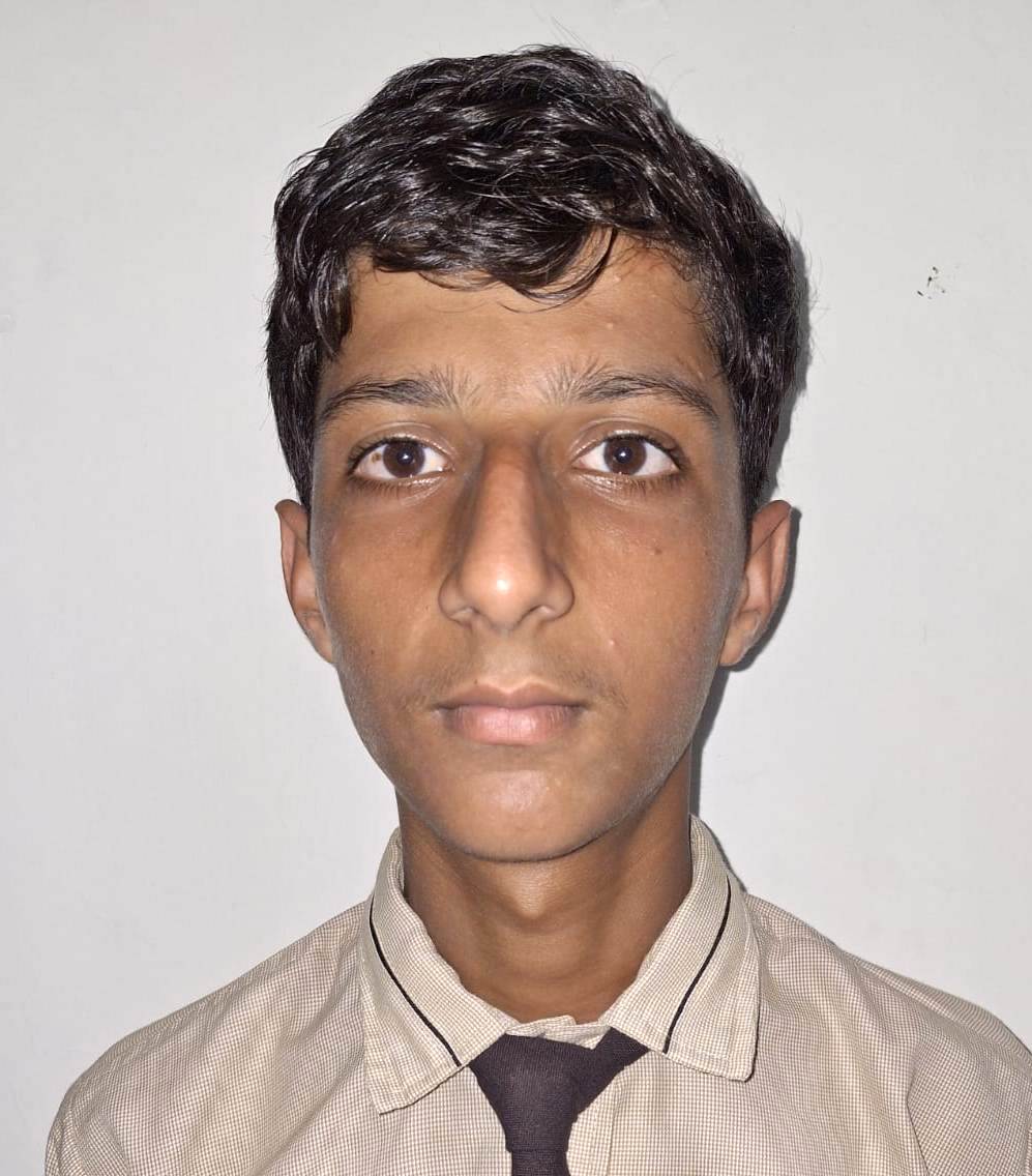 MOHIT